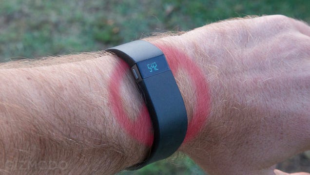 fitbit burning wrist