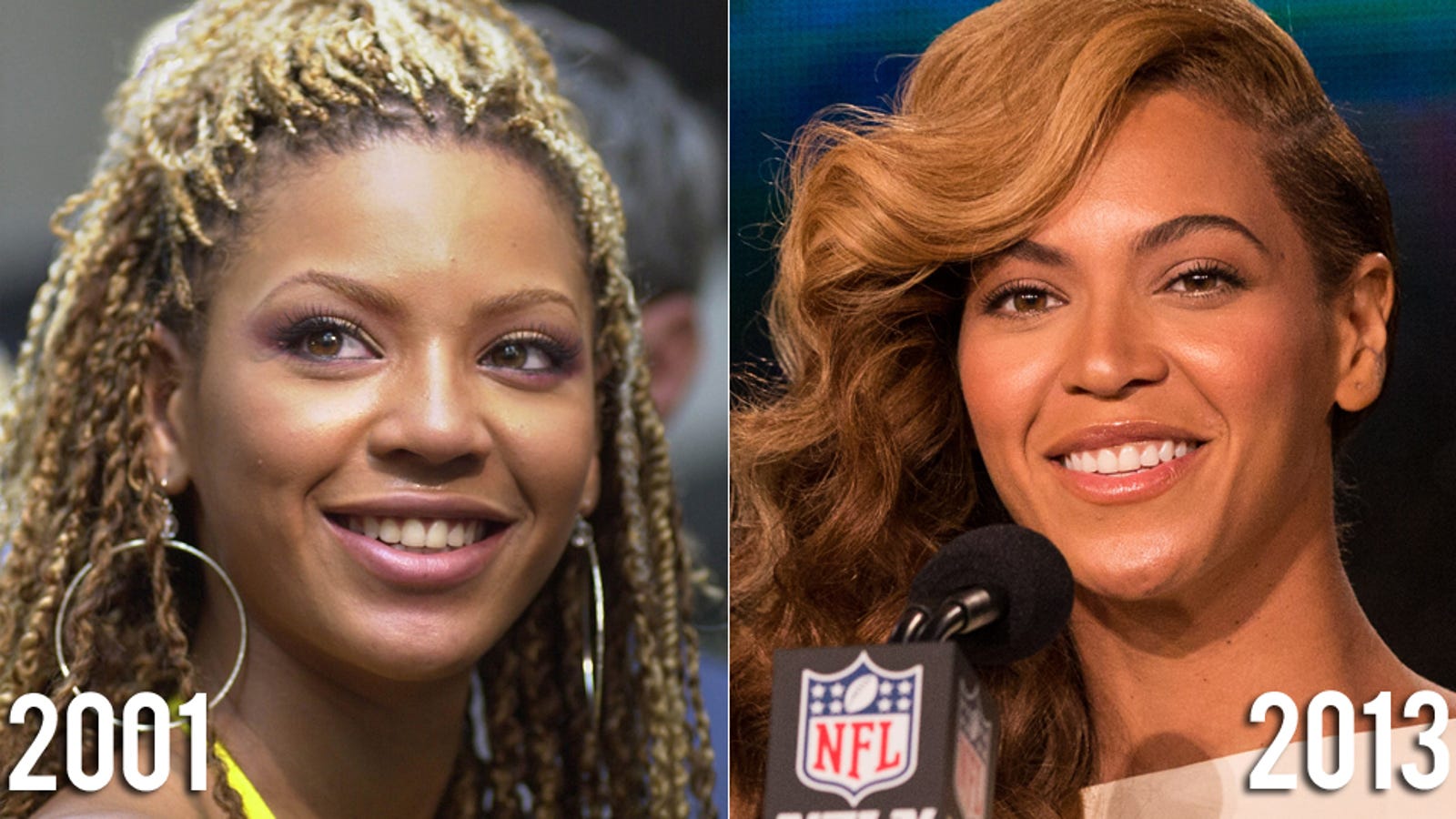 When Did Beyoncé Get a Nose Job?