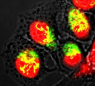 Illustration for article titled Nanotech And Lasers Team Up To Cure Cancer