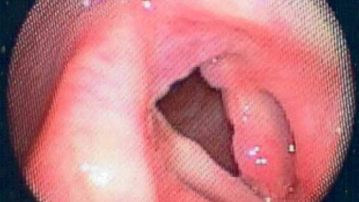Lesbien teens licking pussy List of actors who did nude scene
