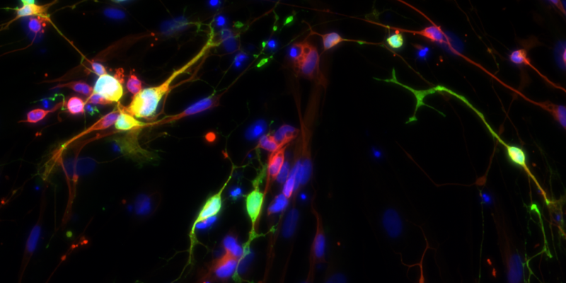 Illustration for article titled Scientists Have Grown Human Serotonin Neurons in the Lab