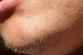 Illustration for article titled Whose Disgusting Baseball Chin Is This?