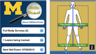 Illustration for article titled Are You Ready to Trust an iPhone App for Skin Cancer Diagnosis?