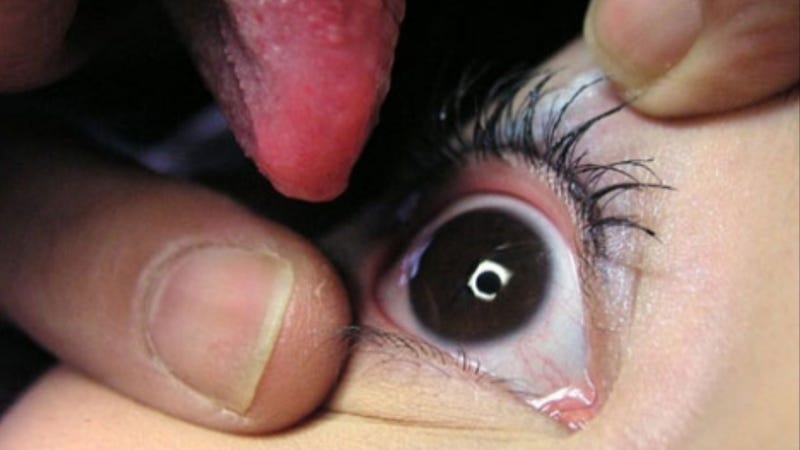 Illustration for article titled This One Time, I Licked My Friend's Eyeball