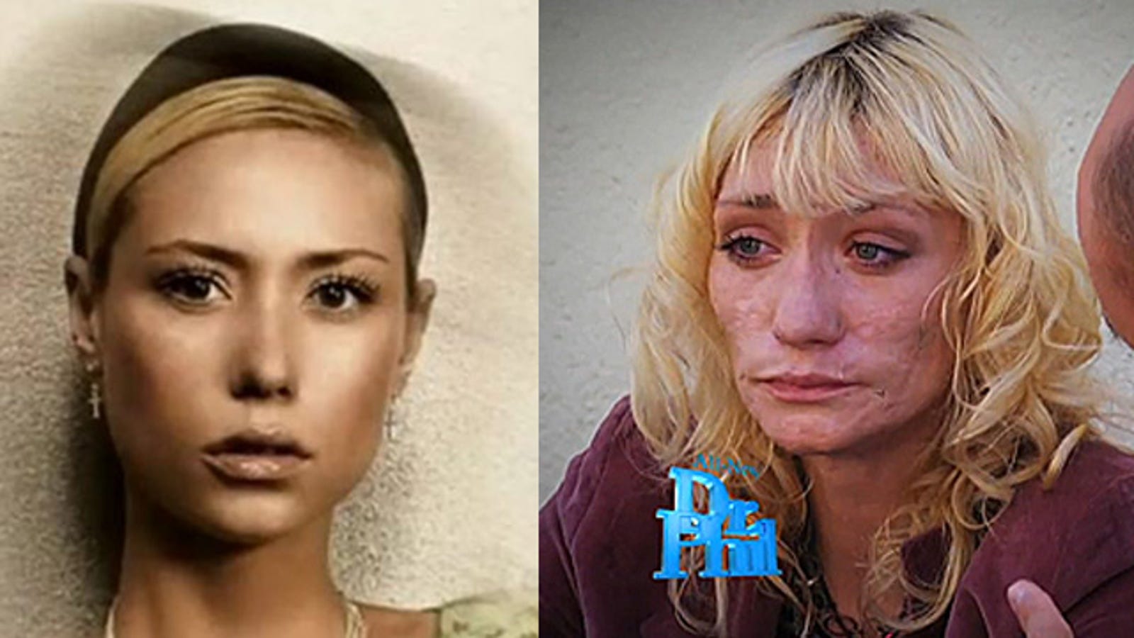 Дочь успенской фото до и после аварии