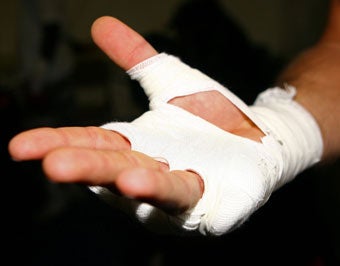 Illustration for article titled Hard-Nosed Boxer Will Perform His Own Surgery, Thank You Very Much