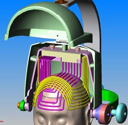 Illustration for article titled Selectively De-Activate Parts of Your Brain with Transcranial Magnetic Stimulation