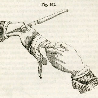 Illustration for article titled A Grisly But Fascinating Tale of the Greatest Medical Revolutionary