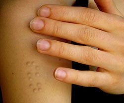 Illustration for article titled Braille Tattoos Are Touchy, Feely
