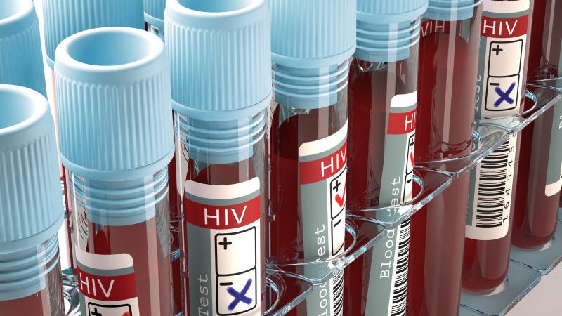 Promising New HIV Vaccine Clinical Trial to Launch in South Africa