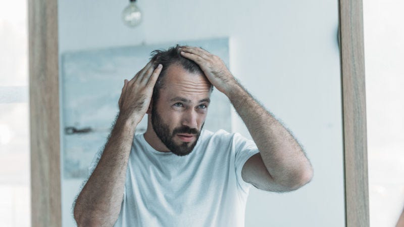 Illustration for article titled Cómo verificar si tu pérdida de cabello está dentro de los límites normales