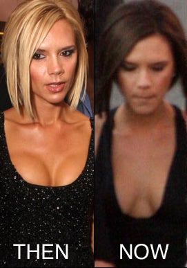 Illustration for article titled Posh Spice's Famous Chest Put To Rest?