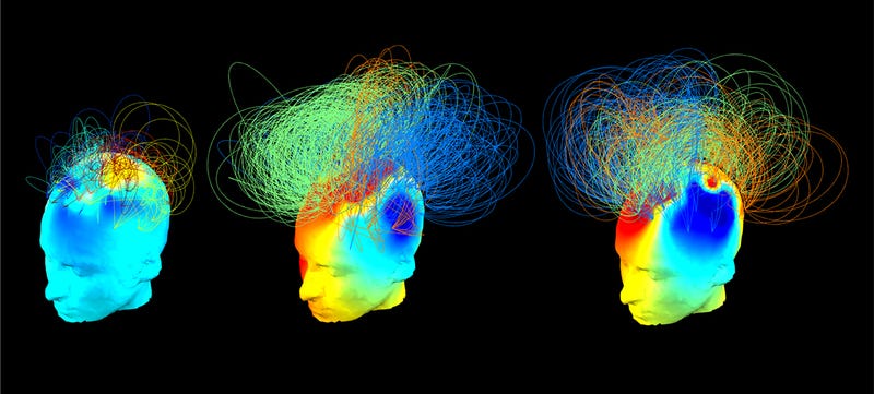 Illustration for article titled The Thoughts of Locked-In Patients, Visualized