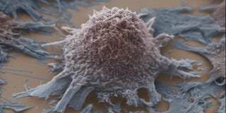 cells cancer sugar starving could attack them way