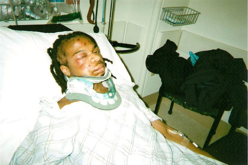 Jordan Miles after being beaten by police