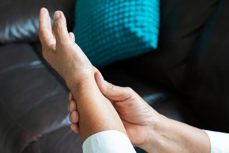 Illustration for article titled How Is Palindromic Rheumatism Treated?