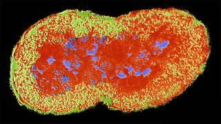 Illustration for article titled Scary Strain of Gonorrhea Is Resistant To All Known Antibiotics