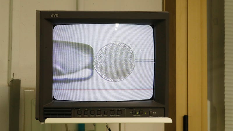 The monitor shows the inseminating of eggs from the last two remaining female of northern white rhinos with frozen sperm at the Avantea laboratory in Cremona, Italy, on August 25, 2019.