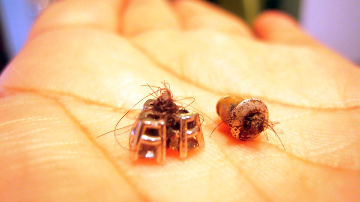 The Grossest Earring Removal Story You Ll Hear This Week