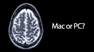 Illustration for article titled Your Brain Scan Looks Different on Mac and PC