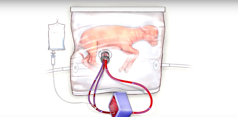 How New Technology Could Threaten A Woman's Right To Abortion