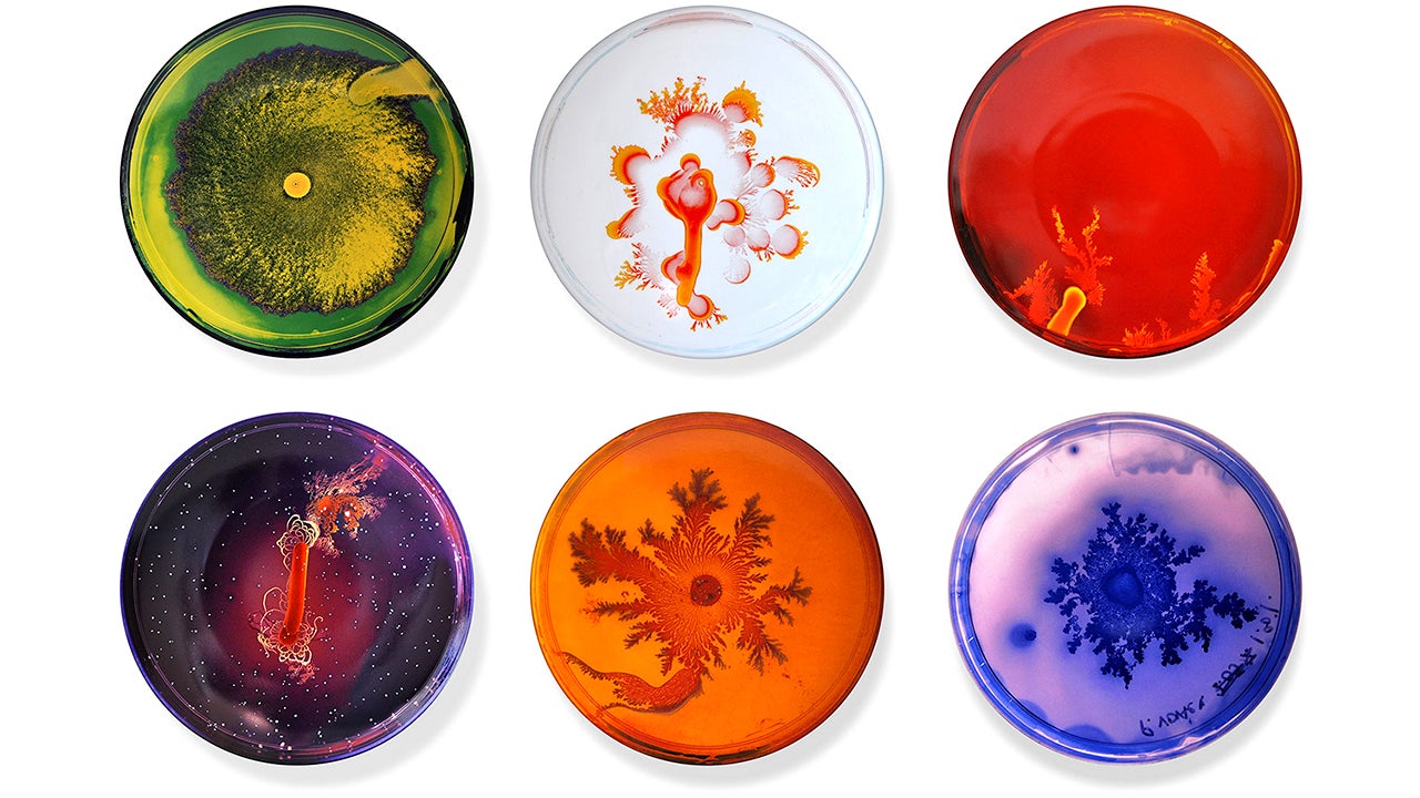 Don't Be Grossed Out, The Bacteria On These Petri Dish Plates Is Art