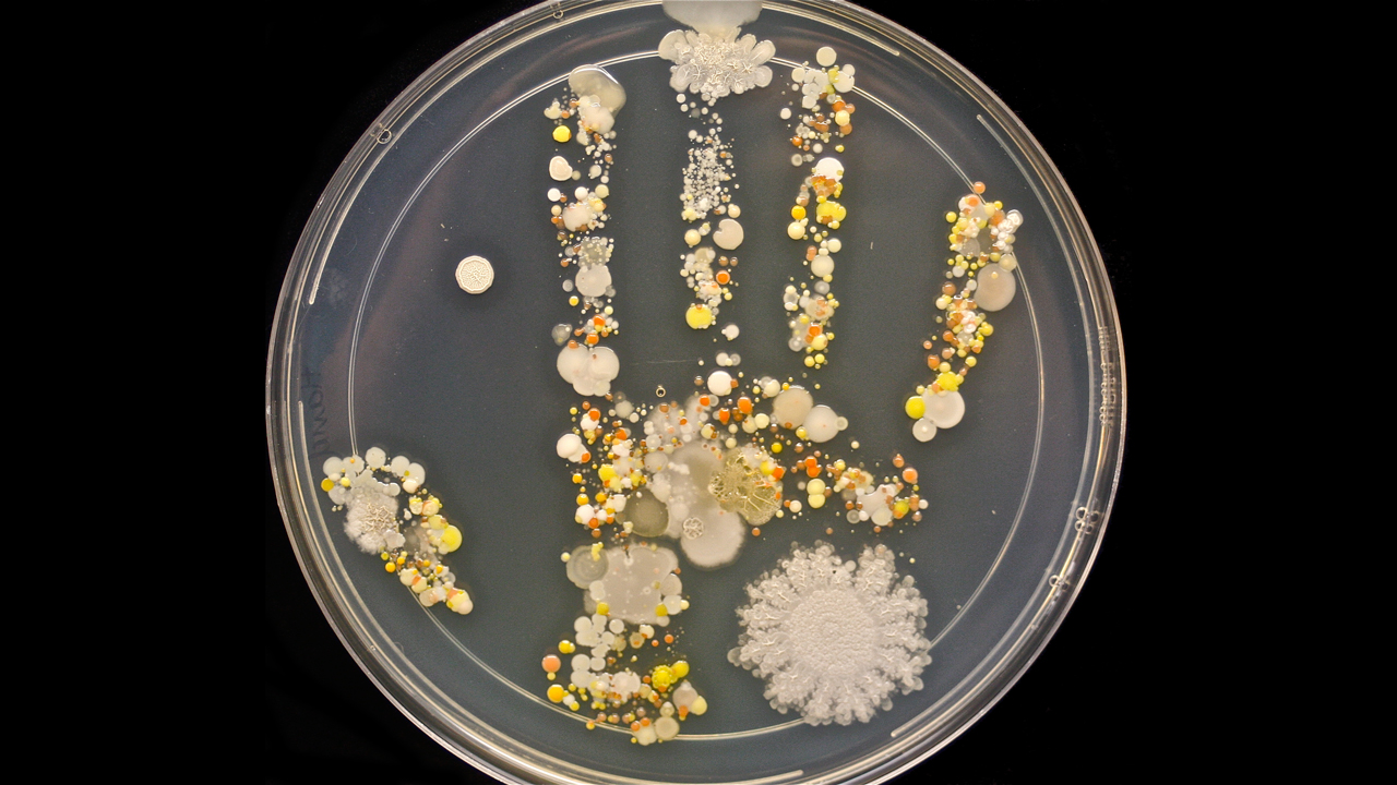 Your Hand Print Is Way More Interesting After A Few Days In A Petri 