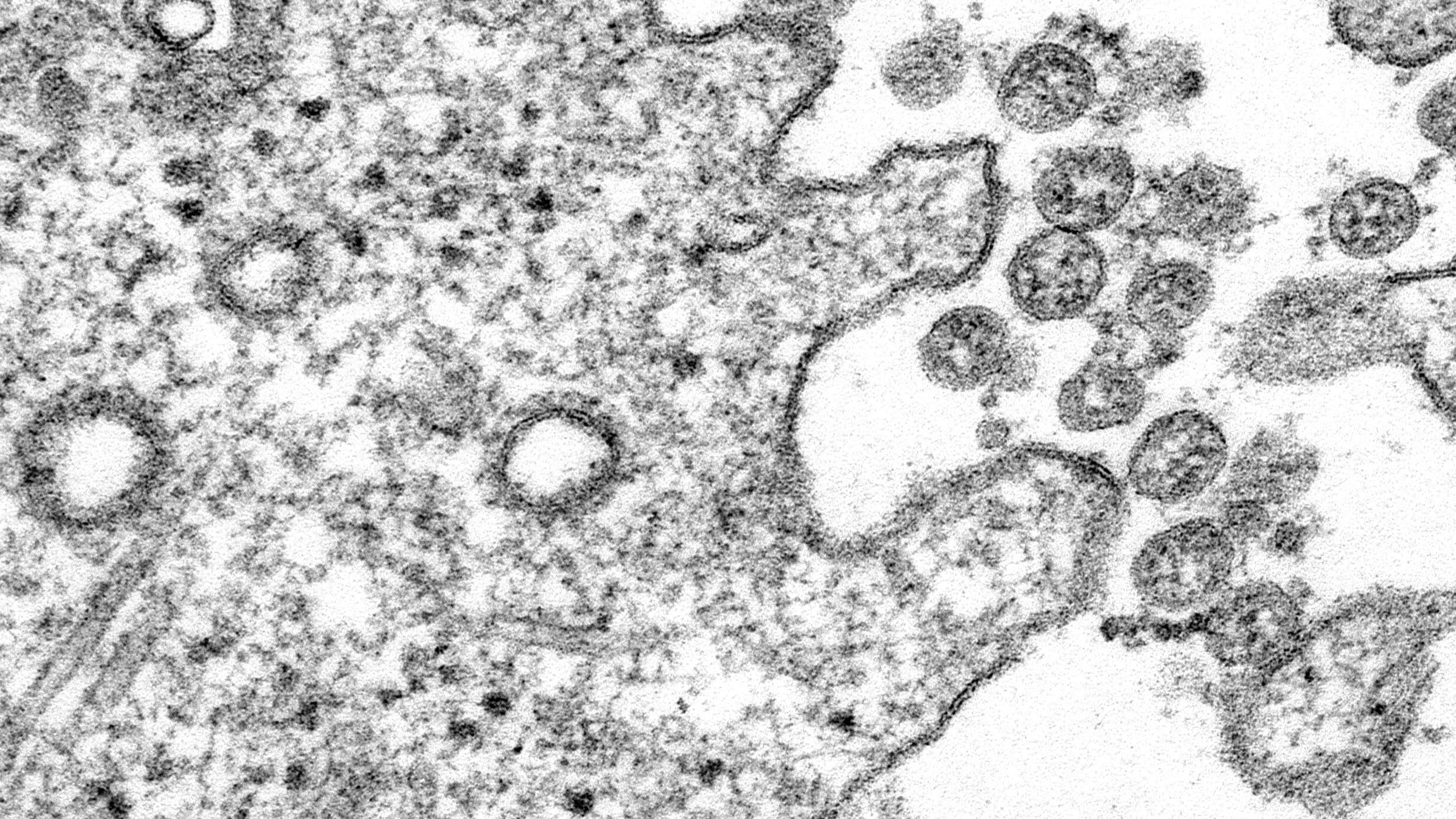What We Think We Know About The Coronavirus Is Going To Keep Changing