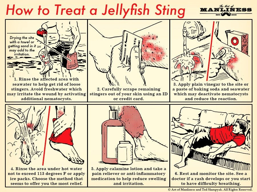 Learn How to Treat a Jellyfish Sting With This Handy Graphic