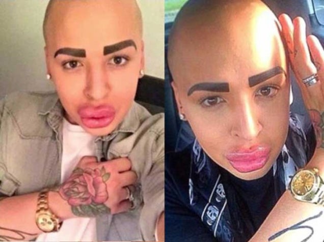 Guy spends $US150,000 in plastic surgery to look like Kim Kardashian