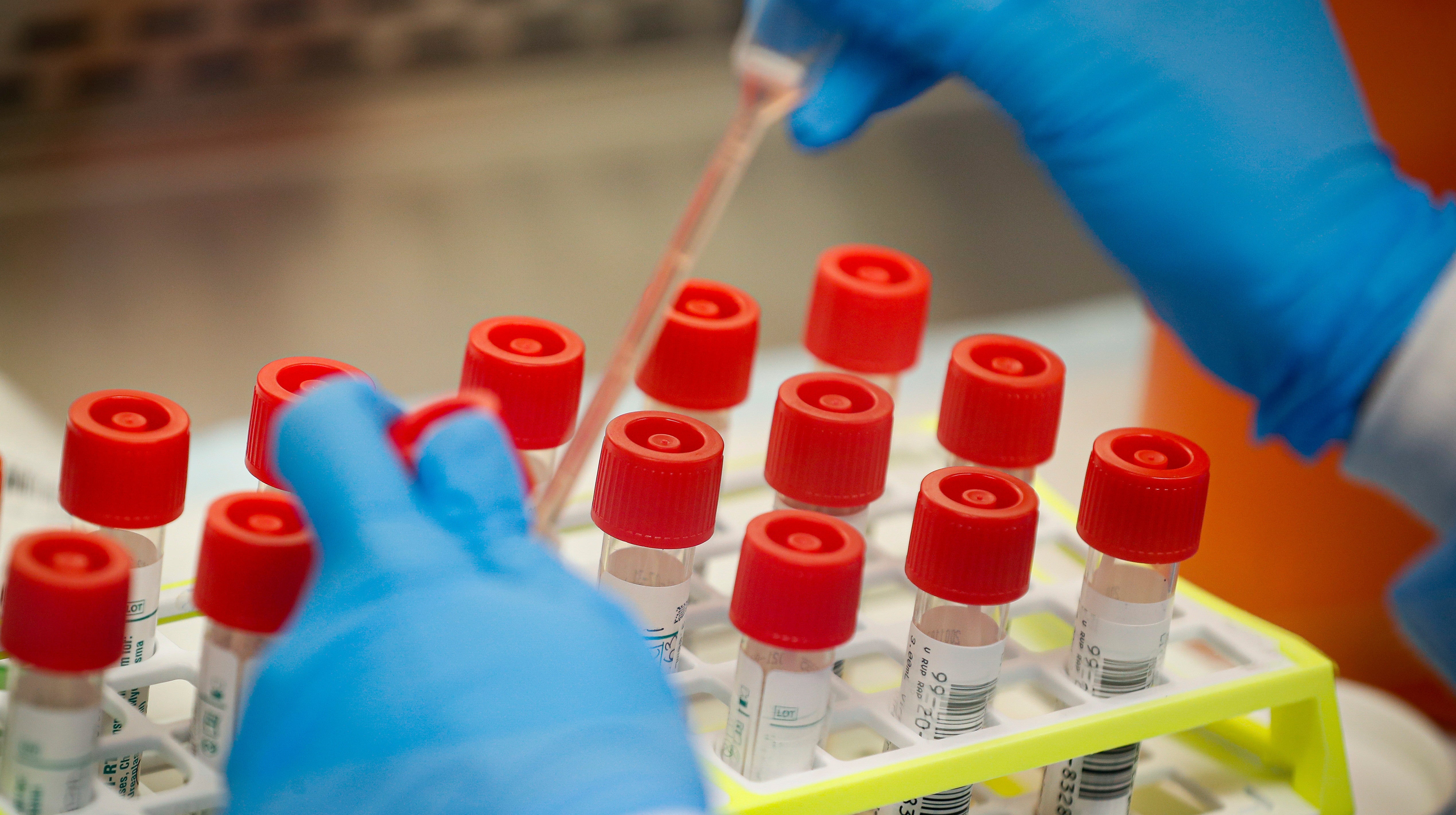 Can Scientists Justify Intentional Coronavirus Infections To Speed Vaccine Creation?