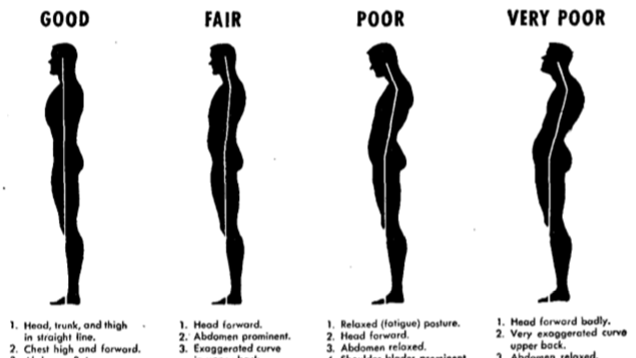 Top 10 Ways to Fix Your Terrible Posture