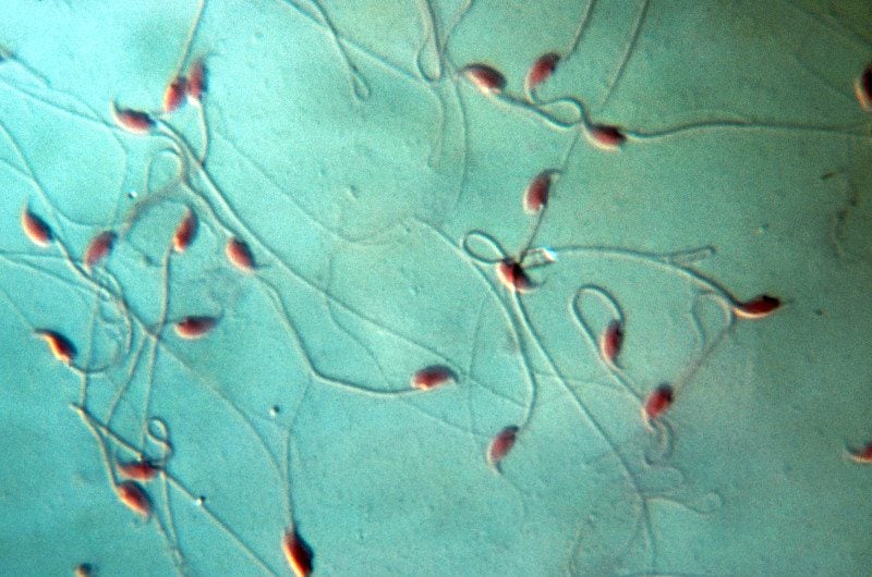 Espermatozoides del experimento. Universidad de Yamanashi