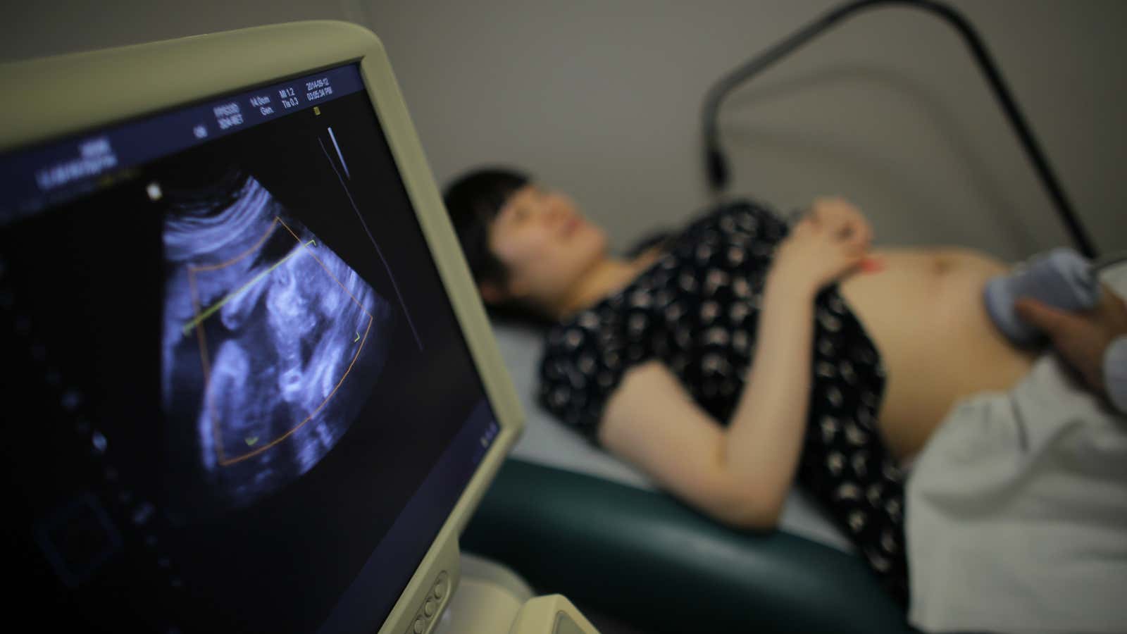 Wu Tianyang, who is five month pregnant with her second child, attends a sonogram at a local hospital in Shanghai September 12, 2014. REUTERS/Carlos Barria…