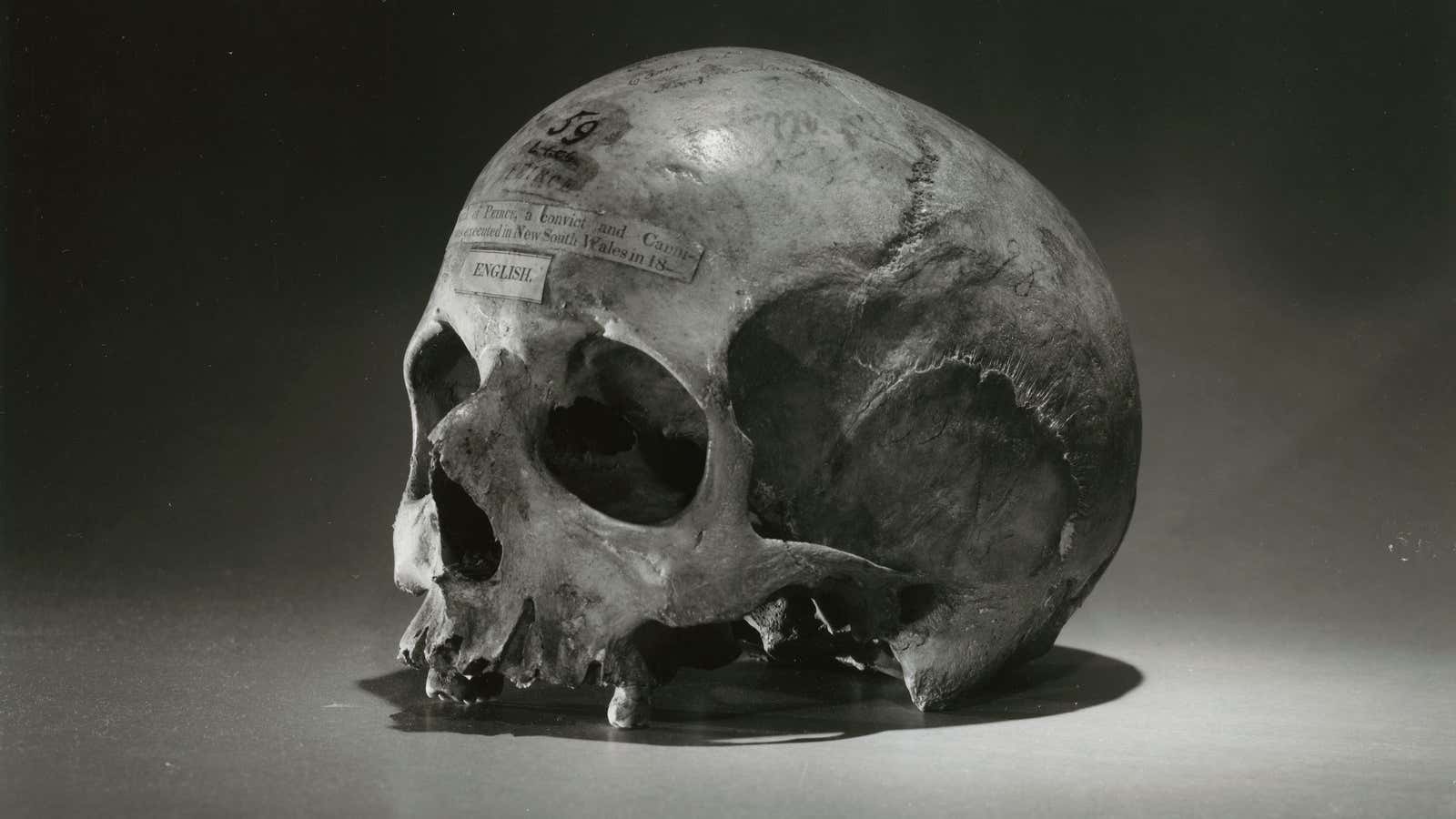 The skull of Alexander Pearce is today held at the University of Pennsylvania, Philadelphia.