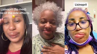 Image for Why Are Black Folk's Lips Swelling Dramatically? Tiktok Doctors Have Some Theories
