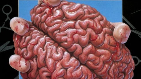 Life & Death II: The Brain