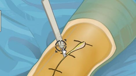 Virtual Knee Surgery