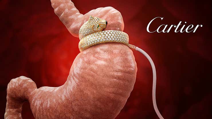 Image for Cartier Introduces New Diamond-Encrusted Gastric Lap-Band