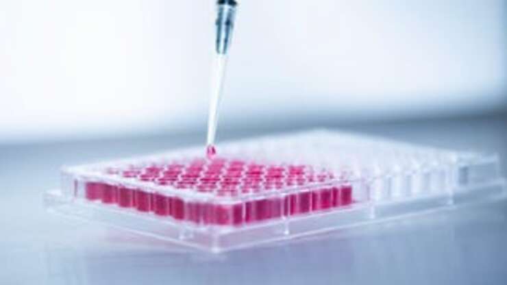 Image for Brain Injection Stopped Progression of Multiple Sclerosis in Trial of 15 People