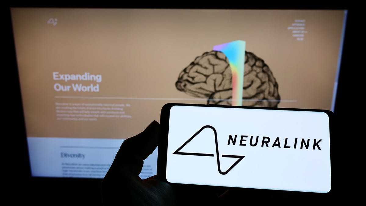 Neuralink diz que seu primeiro implante cerebral humano enfrentou um problema de perda de dados