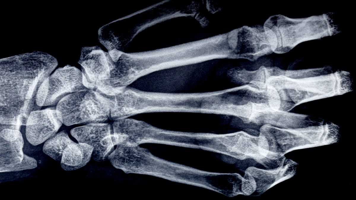 Italian X Rays - Wikipedia