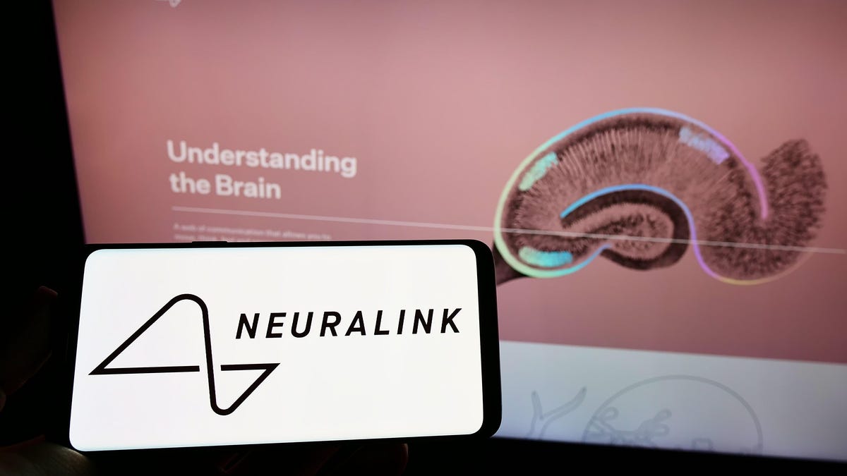 Neuralink, la empresa de implantes cerebrales de Elon Musk, multada por infracción de “materiales peligrosos”