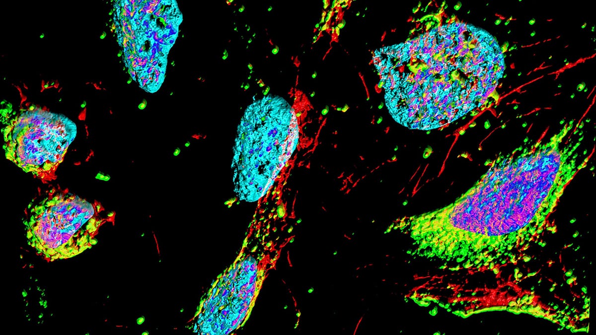 Henrietta Lacks Family Settles With Company Over 'Immortal' Cells