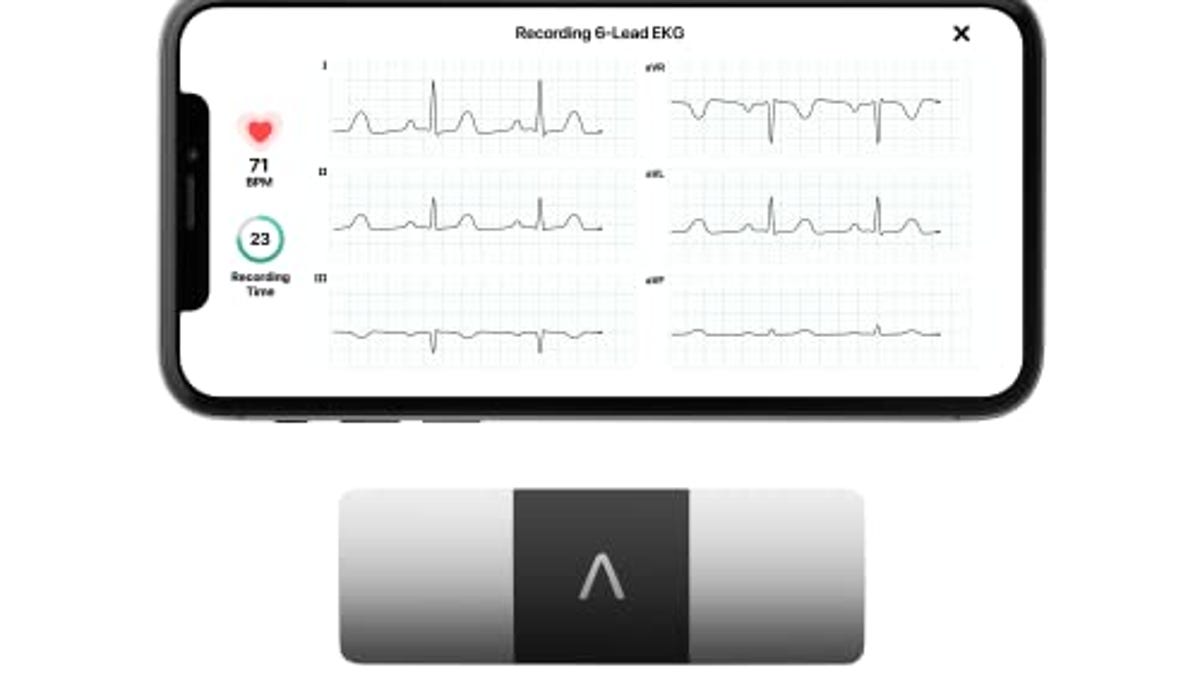 Kardiamobile 6-lead Personal Ekg Monitor, Now 13% Off