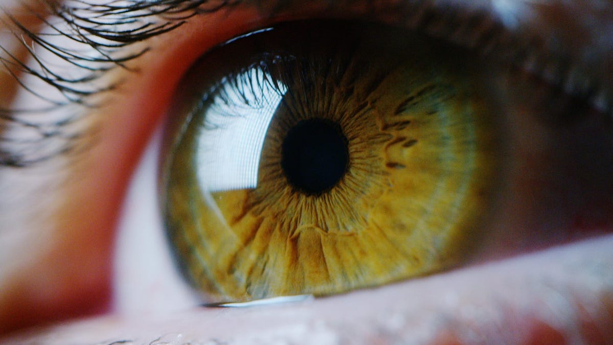 Un hombre se hace un examen de la vista y descubre que ha tenido una astilla clavada en la córnea durante 15 años
