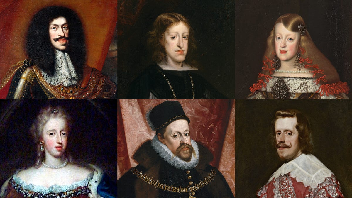 Habsburg Jaw- A Result Of Inbreeding?