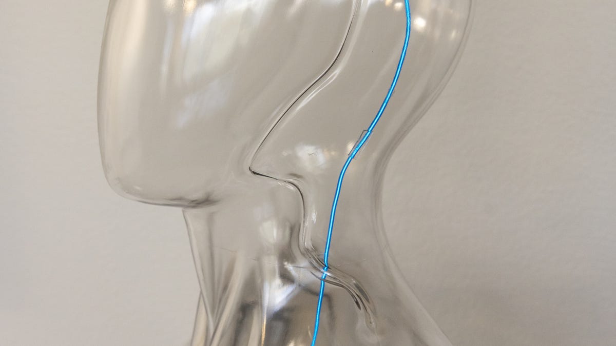 Elon Musk's Neuralink is getting more competition