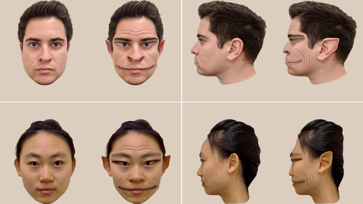 Inquietantes ‘caras de demonios’ muestran cómo es tener un raro síndrome de cara distorsionada