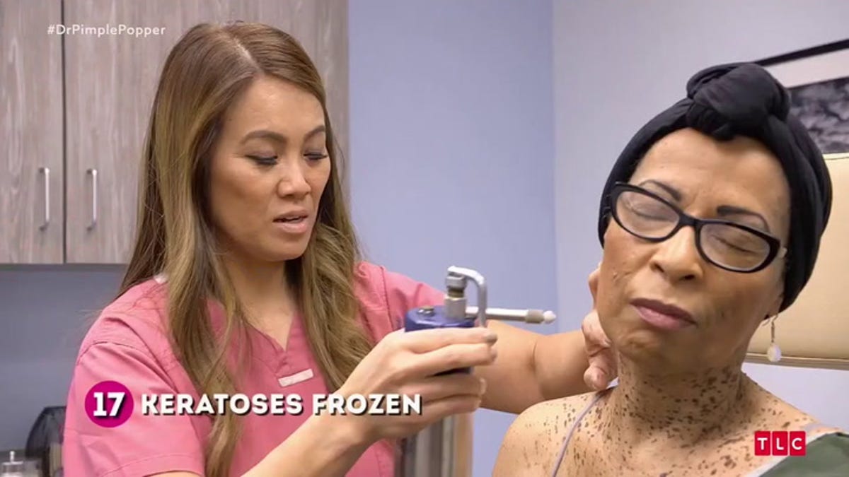 Dr Pimple Popper Season 2 Episode 2 Recap